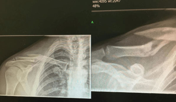 Screen Shot 2017-03-13 at 16.48.16